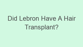 did lebron have a hair transplant 106168