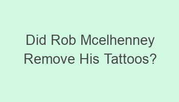 did rob mcelhenney remove his tattoos 106736